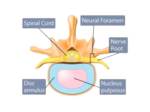 Anatomy of a disc
