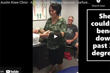 Myoneural Therapy Session Knee Treatment – Same Day Before and After