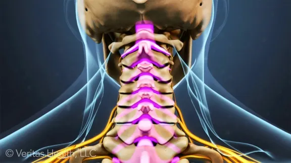 Stiff Necks and Your Spine