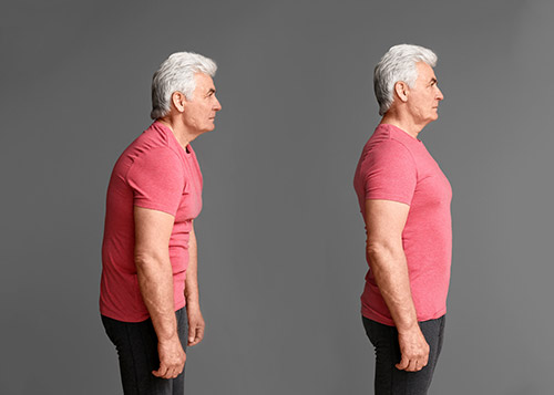 TexStar Chiropractic - Ten Reasons You Need To Fix Your Posture