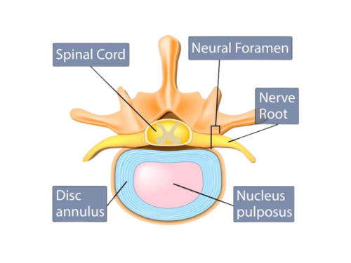 Anatomy of a disc