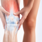 Treatment for Knee Osteoarthritis