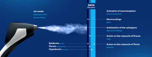 Spot Cryotherapy Stimulation